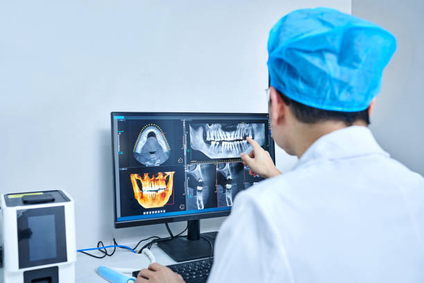 Best Chipped Tooth Repair Near Me  in Union Mill, VA