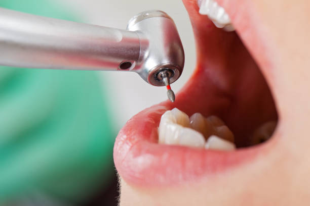  Union Mill, VA Emergency Dentist Pros